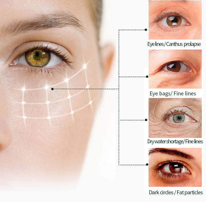 Crystal Patches Under Eye Bags