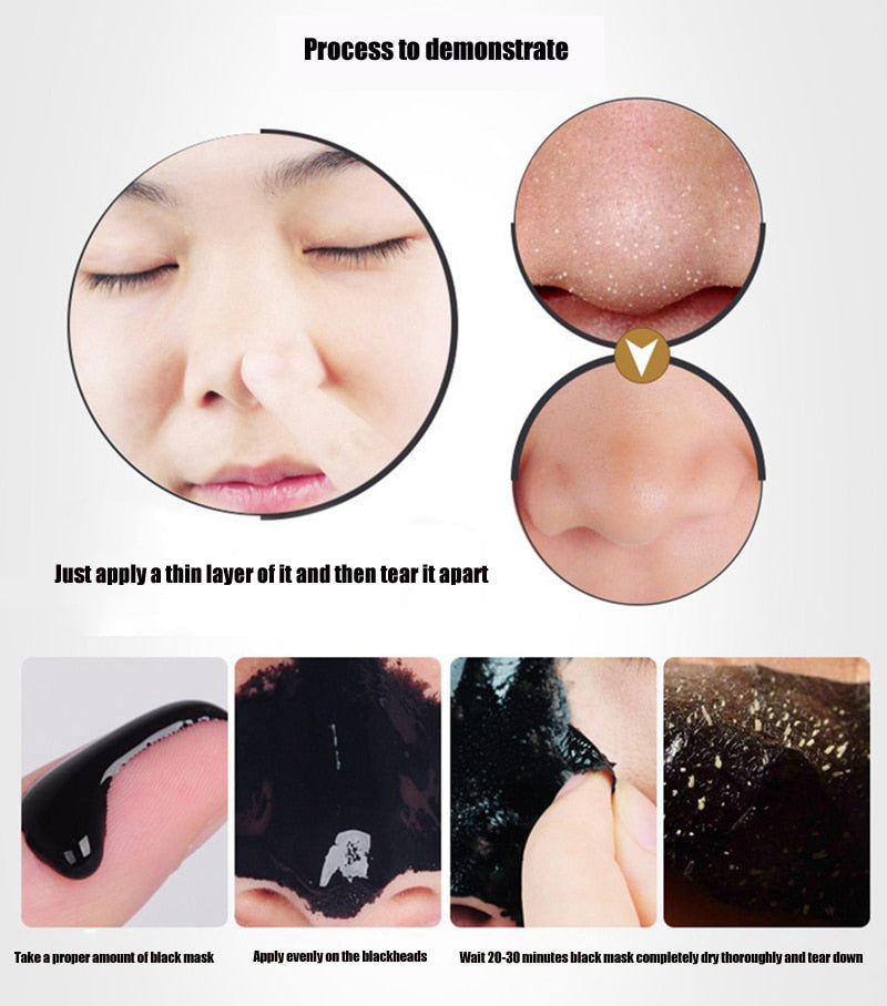 Nose Blackhead Removal