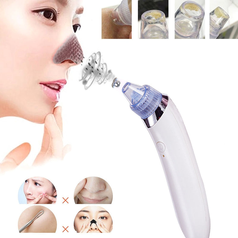 Facial Pore cleaner Blackhead Remover